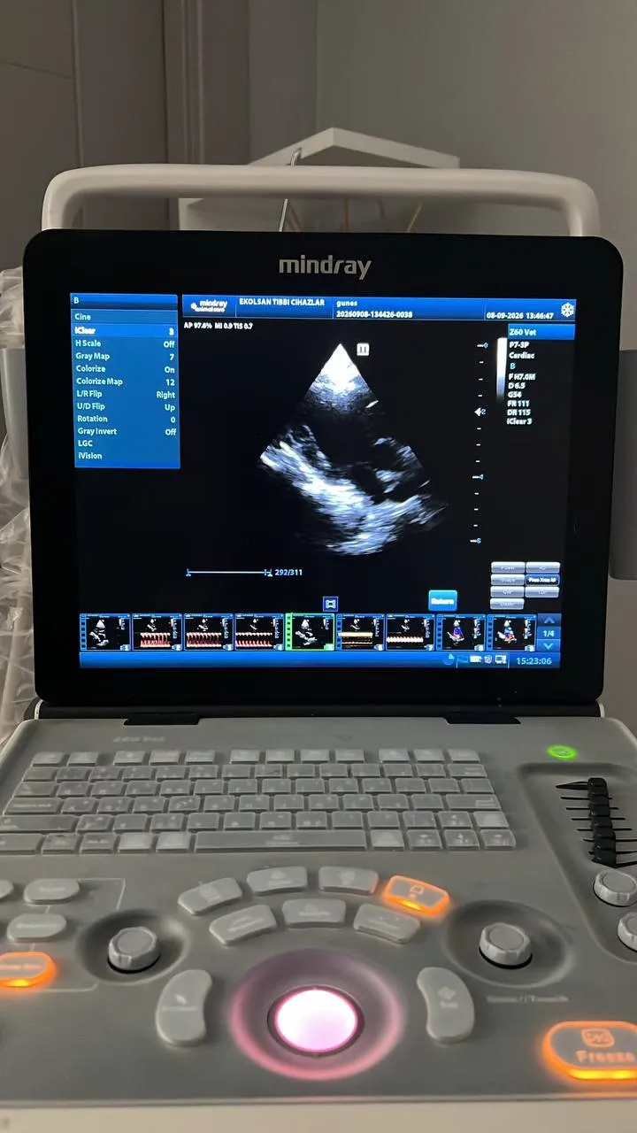Ultrasound and echocardiography